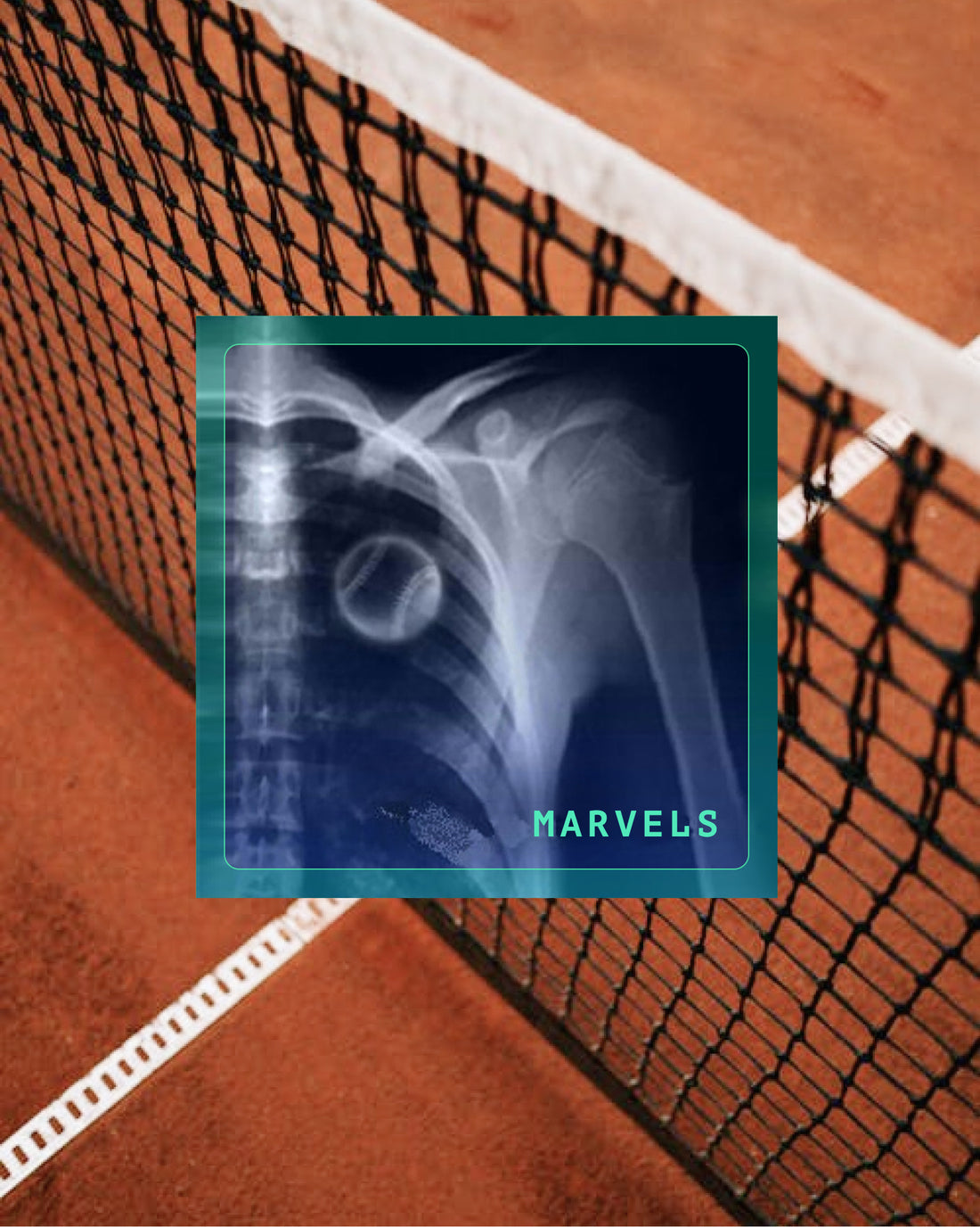 X-ray tennis sticker graphic